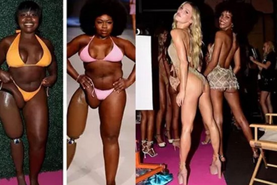 Mẫu ngoại cỡ cụt chân diễn bikini cùng 'chân dài' Victoria’s Secret