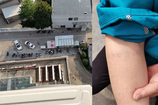 Đang dọn dẹp ngoài chung cư, nữ lao công bị con dao từ 'trên trời' rơi trúng