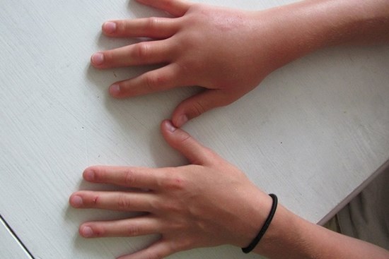 6 dấu hiệu trên bàn tay đang ám chỉ rằng lượng đường trong máu đã quá cao nhưng hầu hết chúng ta đều xem nhẹ