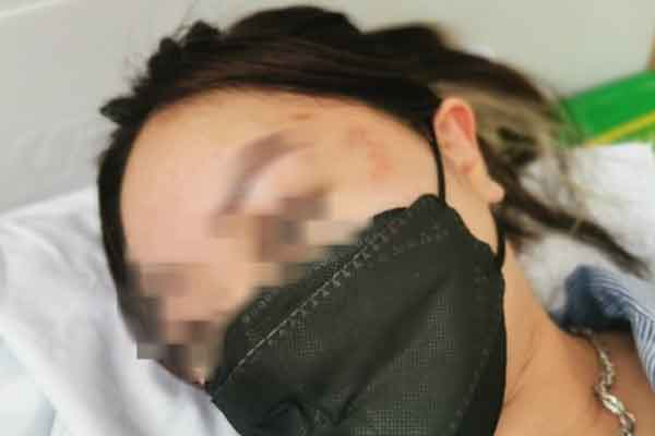 Clip: Đang được sơ cứu, nam thanh niên vẫn cố tình sàm sỡ nữ bác sĩ-1