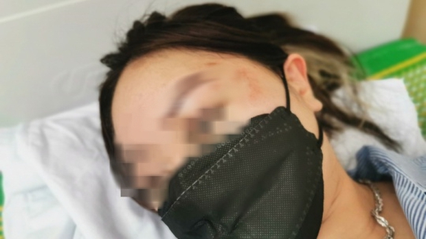 Cô gái trẻ tố bị người đàn ông sàm sỡ, hành hung tại Aeon Mall Long Biên-1