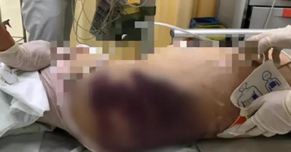 Vụ bé 8 tuổi bị bạo hành: Những hình ảnh chấn động, chưa từng công bố-9