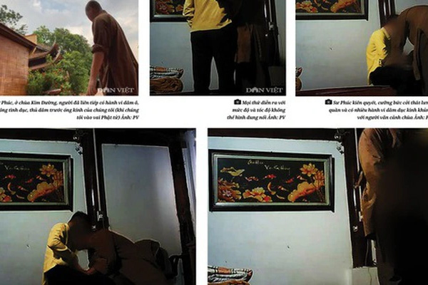 Phú Thọ: Công an vào cuộc vụ bé gái bị hàng xóm dội cả ấm nước sôi vào người-3