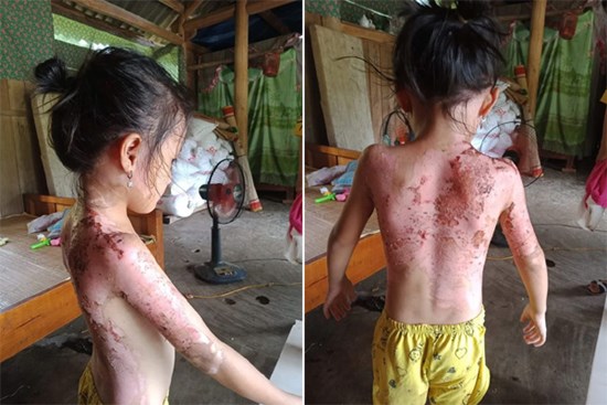 Phú Thọ: Công an 
