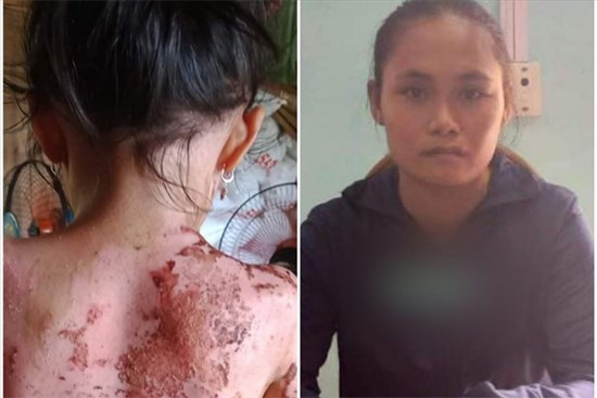 Hé lộ nguyên nhân người hàng xóm hắt ca nước sôi vào bé gái 7 tuổi