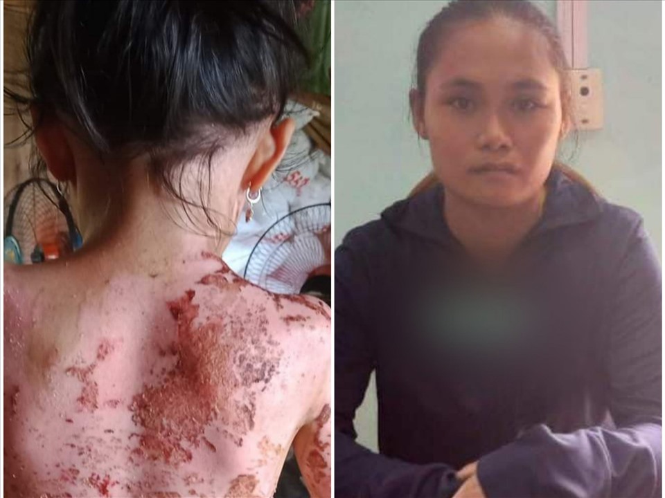 Hé lộ nguyên nhân người hàng xóm hắt ca nước sôi vào bé gái 7 tuổi-1