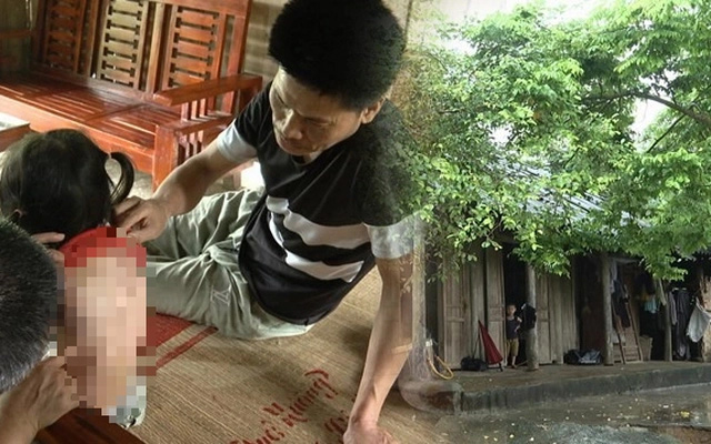 Bé 7 tuổi bị hàng xóm tạt cả ca nước sôi vào người: Sao nỡ lòng ra tay dã man như thế?-1