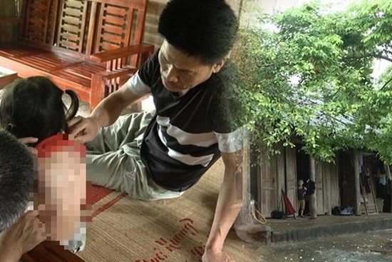Bé 7 tuổi bị hàng xóm tạt cả ca nước sôi vào người: 'Sao nỡ lòng ra tay dã man như thế?'
