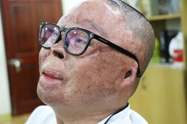 Người sống sót duy nhất vụ rơi máy bay Mi 171 đau đáu tâm niệm với đồng đội hy sinh-2