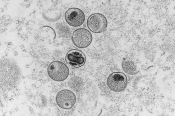 WHO tuyên bố đậu mùa khỉ là tình trạng khẩn cấp toàn cầu-2