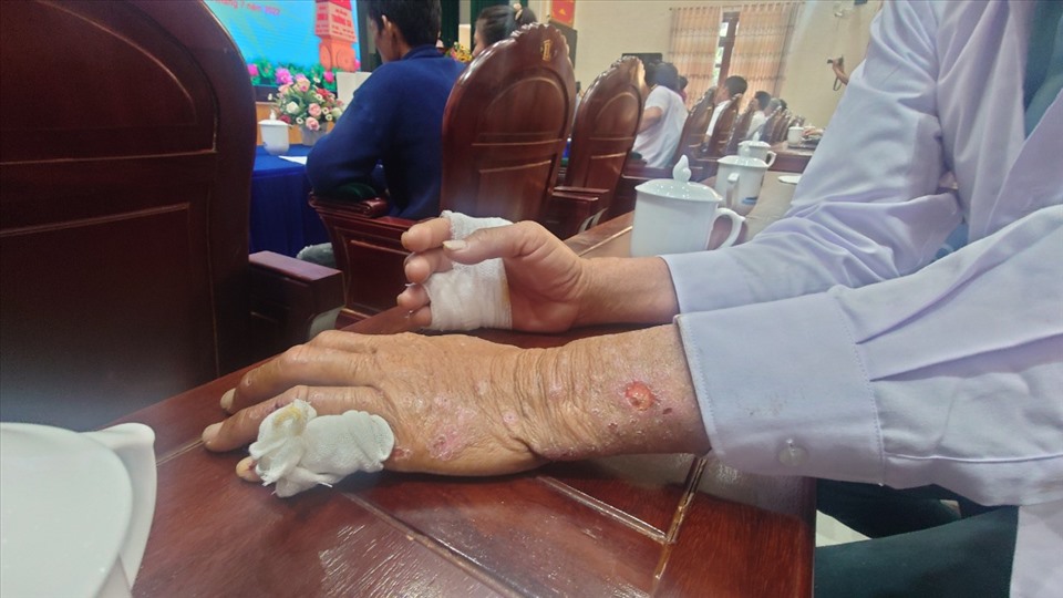 12 ngày trôi dạt trên biển của 5 ngư dân Bình Thuận: Ăn bất cứ thứ gì nổi trên biển, cả rác thải!-3