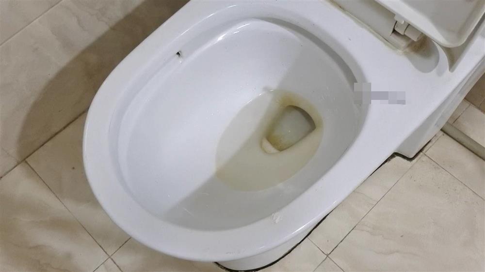 Thành trong của bồn cầu bị ố vàng, chỉ cần rắc thứ bột này vào, tất cả các vết bẩn được loại bỏ sạch sẽ mà mùi hôi cũng chẳng còn-1