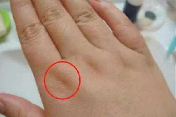 Vết lõm độc lạ trên bàn tay báo hiệu hồng phúc tràn đầy, hậu vận hưởng trọn vinh hoa phú quý-1