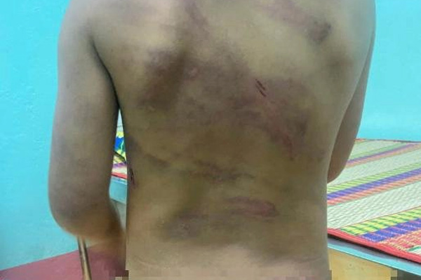 Cháu bé một tuổi bị cặp vợ chồng hành hạ, dán miệng bằng băng dính-2