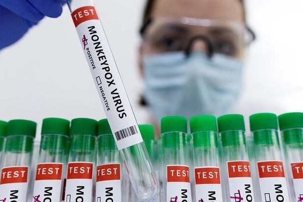 Nóng: Bộ Y tế ban hành hướng dẫn chẩn đoán, điều trị và phòng bệnh đậu mùa khỉ ở người-2