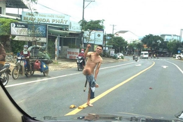 Gã đàn ông có biểu hiện ngáo đá đâm nhiều người ở TP.HCM-2