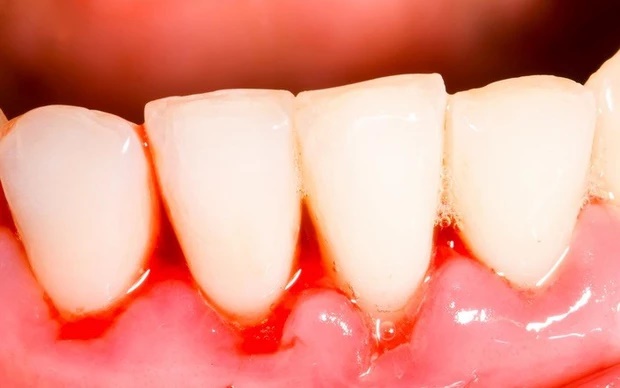 Có đủ 4 dấu hiệu vào buổi sáng thì 90% bạn đã mắc bệnh về gan, mong rằng bạn không có bất kỳ điều nào-2