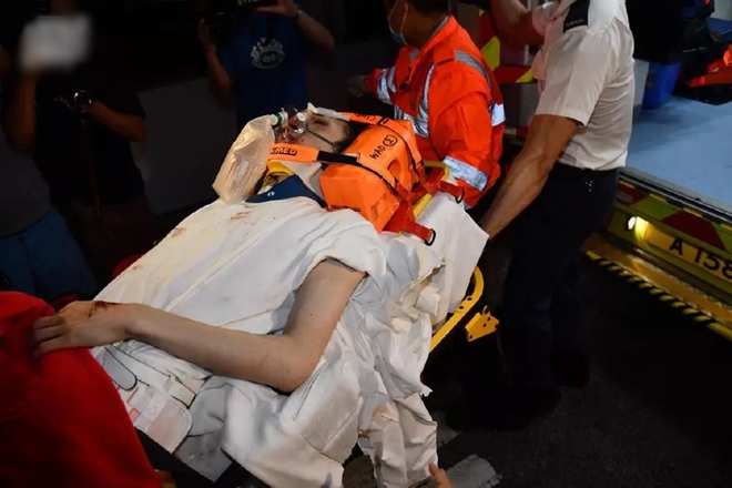 Hé lộ nguyên nhân màn hình 600 kg rơi khiến vũ công bị liệt tứ chi-3