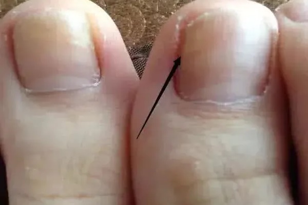 Nếu có 3 thứ trên bàn chân thì xin chúc mừng, chức năng của thận vẫn còn tương đối khỏe mạnh-1