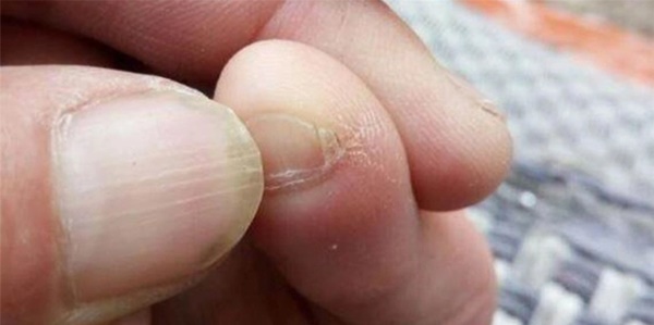 Nếu có 3 thứ trên bàn chân thì xin chúc mừng, chức năng của thận vẫn còn tương đối khỏe mạnh-2