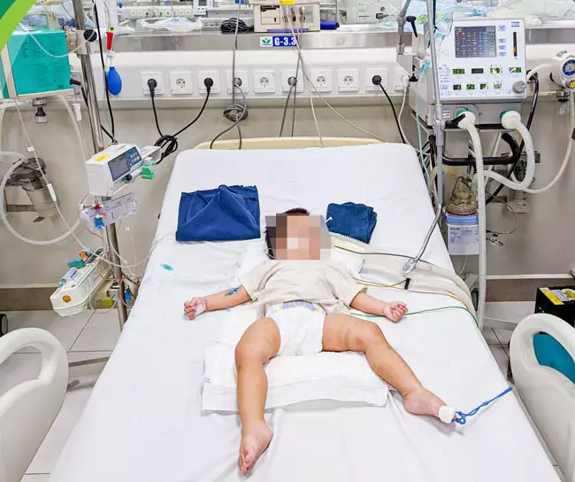 Hình ảnh vết lằn, bầm tím trên người bé 1 tuổi nghi bị bạo hành ở Hà Nội-1