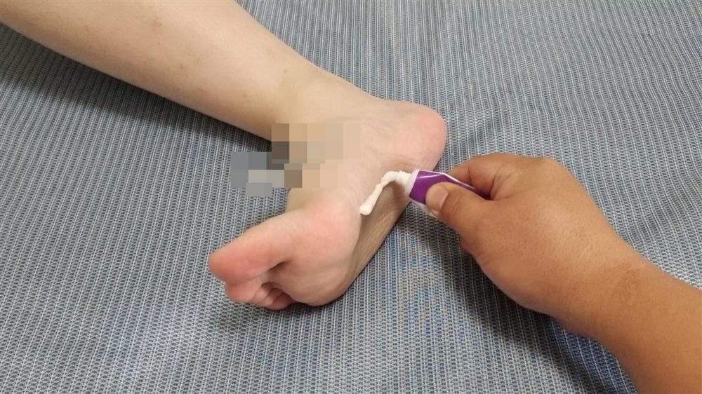 Trước khi đi ngủ, thoa một ít kem đánh răng lên lòng bàn chân có thể giải quyết được các vấn đề mà nhiều người mắc phải-1