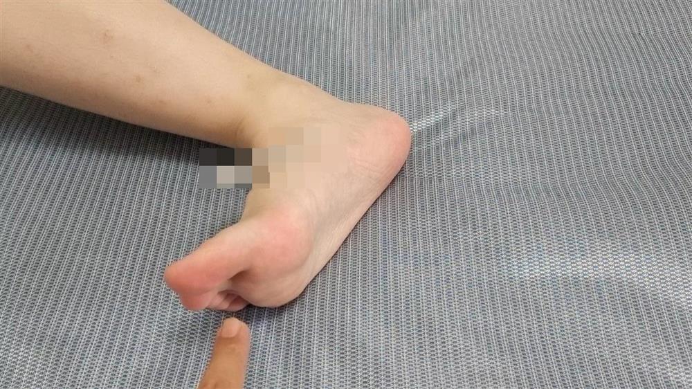 Trước khi đi ngủ, thoa một ít kem đánh răng lên lòng bàn chân có thể giải quyết được các vấn đề mà nhiều người mắc phải-2