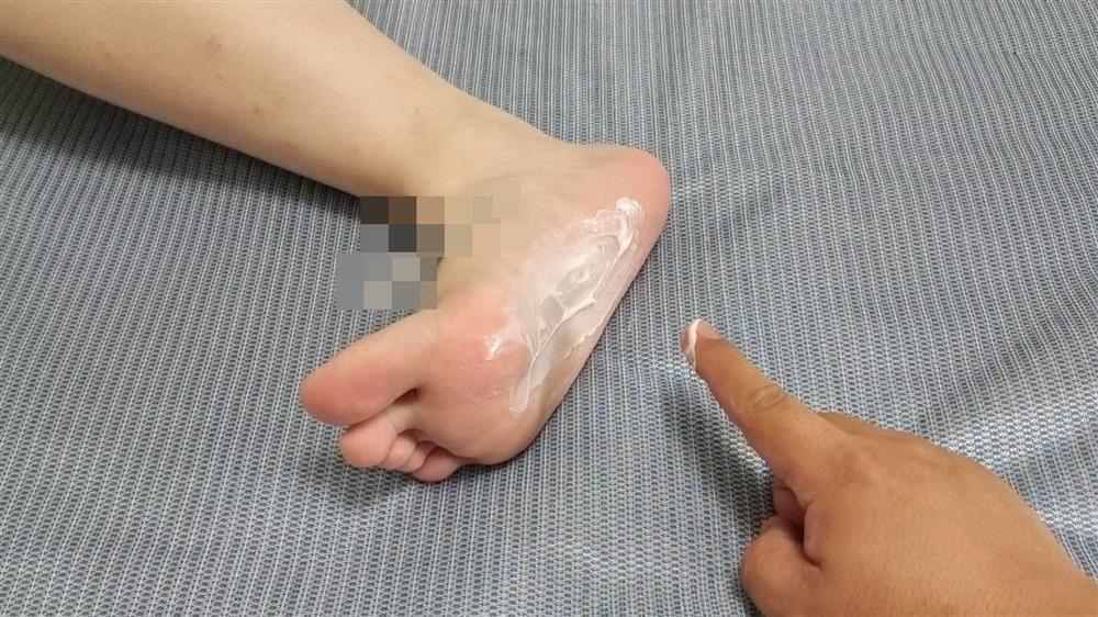 Trước khi đi ngủ, thoa một ít kem đánh răng lên lòng bàn chân có thể giải quyết được các vấn đề mà nhiều người mắc phải-3