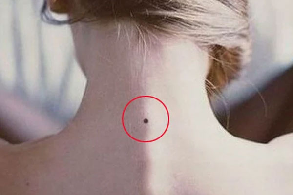 Cổ nhân dạy: Người có 4 nốt ruồi hồng phúc, cuộc đời may mắn, tiền của dư dả-4