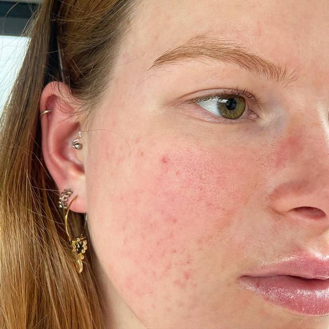 Có một tác nhân gây lão hóa da không thua gì tia tử ngoại mà chị em hay bỏ qua-2