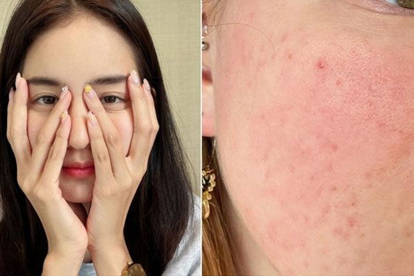 5 thói quen xấu được mệnh danh là máy gia tốc” quá trình lão hóa của phụ nữ, bất ngờ khi gội đầu thường xuyên đứng thứ 2-6