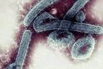 Trung Quốc phát hiện loại virus mới, chưa có thuốc chữa-1