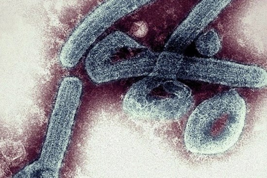 Thêm người chết vì loại virus gây tử vong tới 90%