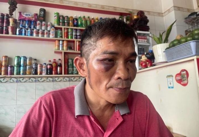 Nguyên nhân con trai danh ca Chế Linh bị đánh hội đồng đến bất động-1