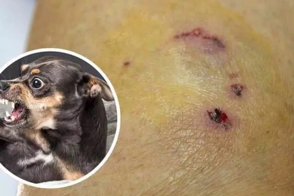 Bộ Y tế cảnh báo nguy cơ bùng phát bệnh dại-1