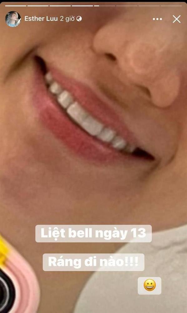 Tình hình hiện tại của Hari Won sau 13 ngày bị liệt một bên mặt-1