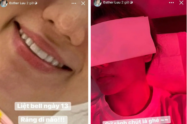 Hari Won sau 6 năm kết hôn với MC Trấn Thành: Sự nghiệp rực rỡ nhưng tình trạng sức khỏe đáng báo động-6