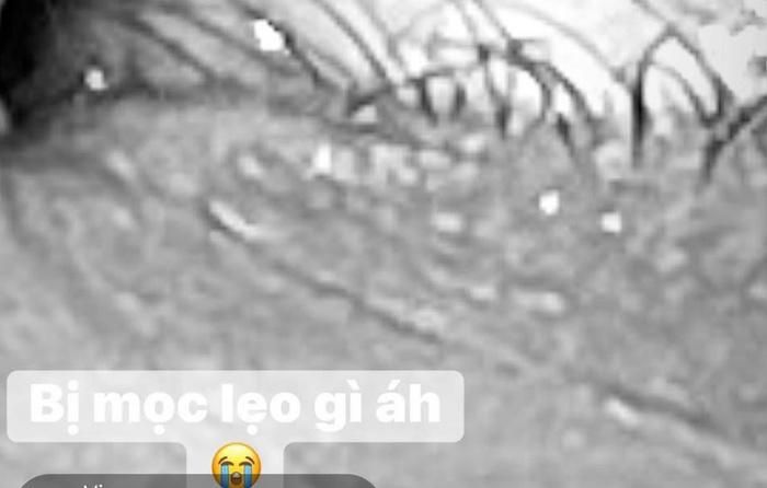 Hết liệt cơ mặt, Hari Won tiếp tục gặp sự cố ở mắt-2