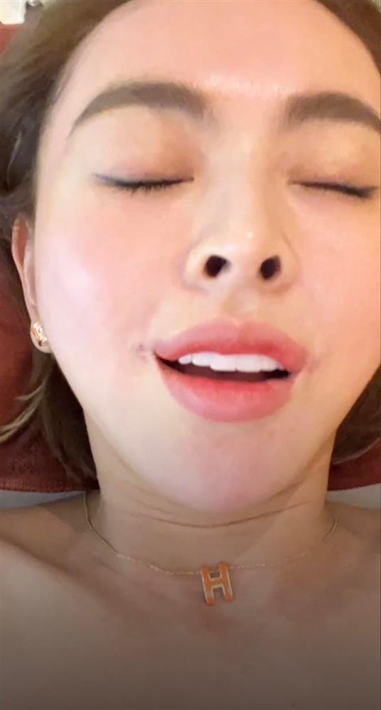 Trang Nemo xuất hiện với mặt tiền như bị bỏng nặng-3