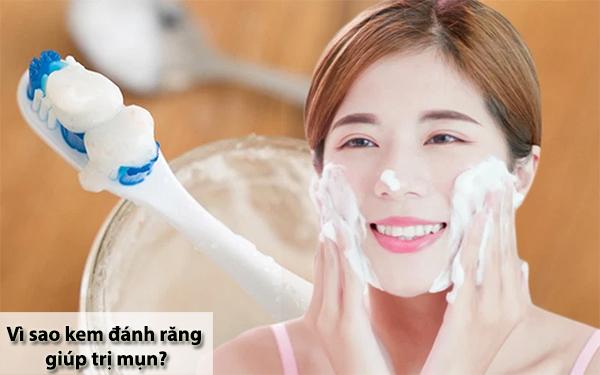 Bôi kem đánh răng lên mụn có được không, có gây hại tới da không?-1