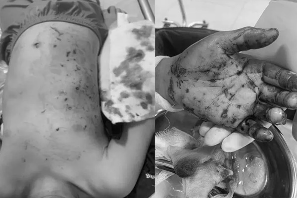 Clip: Ném que diêm vào nắp cống, cậu bé bị hất văng lên không trung-1