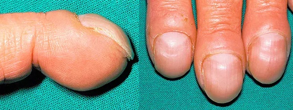 Triệu chứng rõ ràng cảnh báo bất ổn của trái tim-3