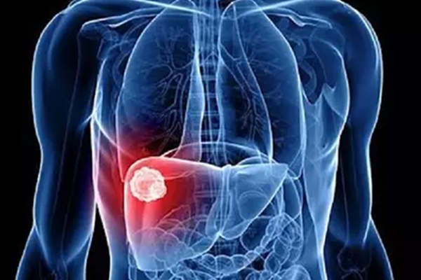 Dùng chảo chống dính sai cách, ung thư gan sẽ cao hơn gấp 4 lần, chuyên gia chỉ rõ cần điều chỉnh thói quen này!-2