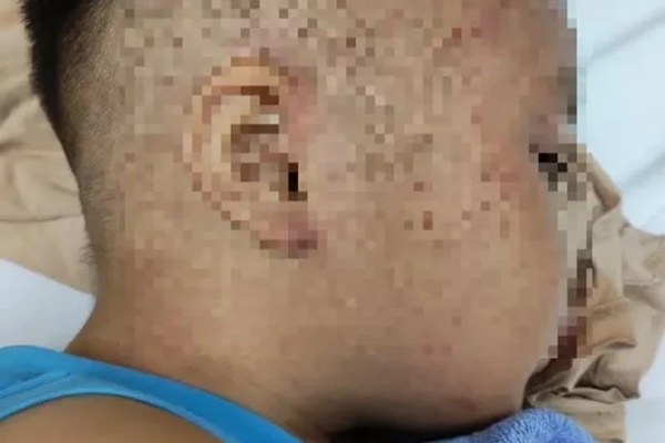 Bé 3 tuổi bị nhốt vào tủ đông: Nếu phát hiện muộn có thể dẫn đến tử vong-2