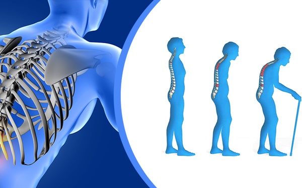 Căn bệnh có thể gây tàn phế từ người trẻ đến người già-1