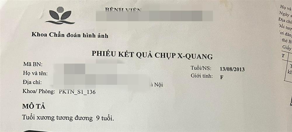 Mẹ rụng rời chân tay khi biết con gái mới 8 tuổi nhưng xương tương đương 11 tuổi, chỉ cao 1m48 là tối đa, bác sĩ cảnh báo sẽ có kinh nguyệt bất cứ lúc nào-1