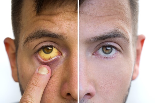 Miệng bị khô và đắng khi ngủ ban đêm thì cần đi khám ngay vì có thể bạn đang mắc 5 bệnh này-7