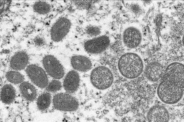 Phát hiện ca nghi nhiễm virus đậu mùa khỉ đầu tiên từ người sang chó-1