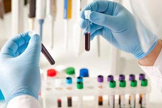 Ngày 16/8, Việt Nam ghi nhận số ca mắc COVID-19 kỉ lục, tăng gần 1.300 ca so với 24 giờ trước