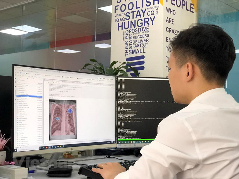 VinBrain đưa công nghệ chẩn đoán hình ảnh bằng trí tuệ nhân tạo đến Myanmar-4